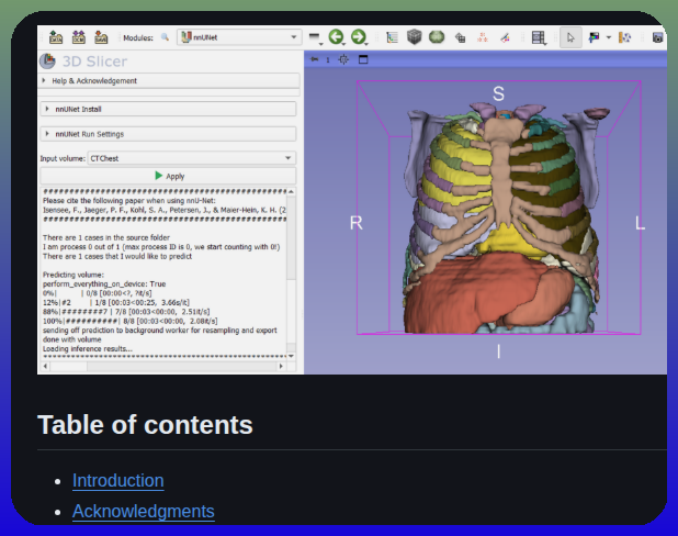 Kitwaremedical Slicernnunet screenshot